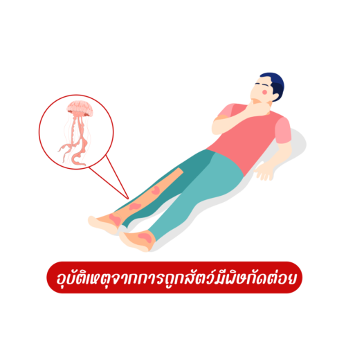 สัตว์มีพิษกัดต่อย